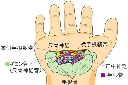 ギヨン管と手根管