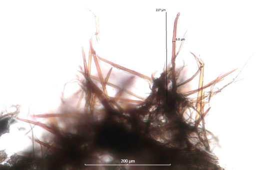 Bild 3 - Hymenialsetae (B. Miggel)