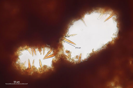 Bild 4 - Fuscoporia ferruginosa, Hymenialsetae (B. Miggel)