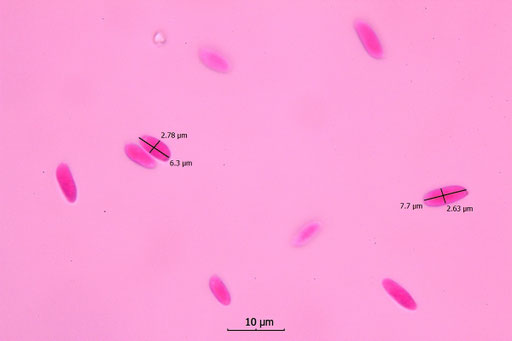 Bild 4 - Antrodia serialis-Sporen in Phloxin (Foto: B. Miggel)