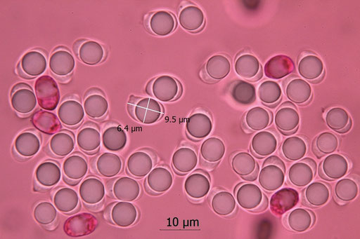 Bild 6 –  Sporen, angefärbt in Phloxin. Foto: Bernd Miggel.