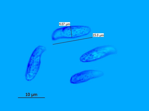 Bild 4 – Sporen, angefärbt in Baumwollblau (B. Miggel)