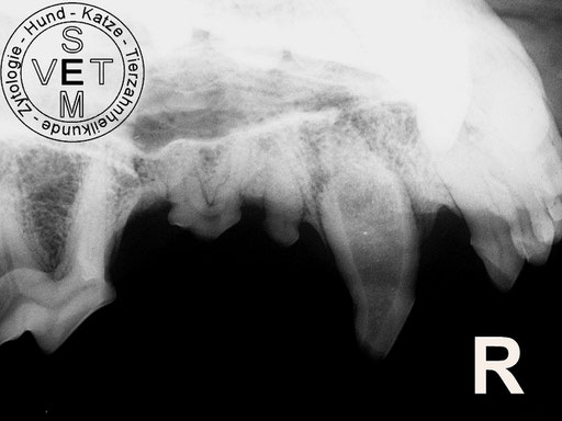 Röntgen zeigt pulpenoffenen, seit Jahren avitalen Caninus mit Auflösung der Wurzelspitze