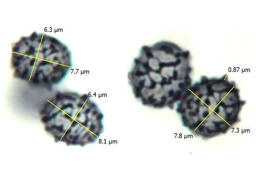 Bild 4 - Sporencollage in Melzers Reagenz (B. Miggel)