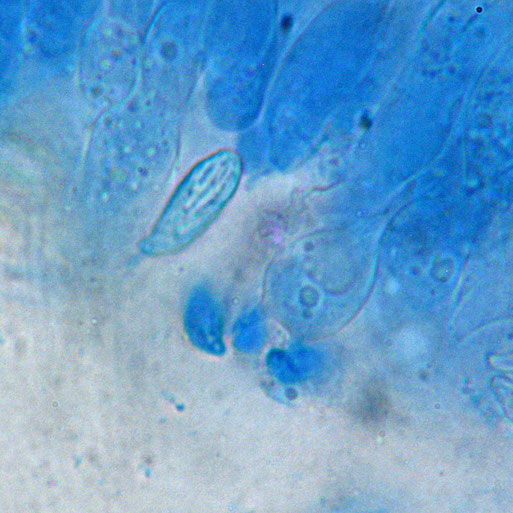 Bild 4 (B. Miggel)