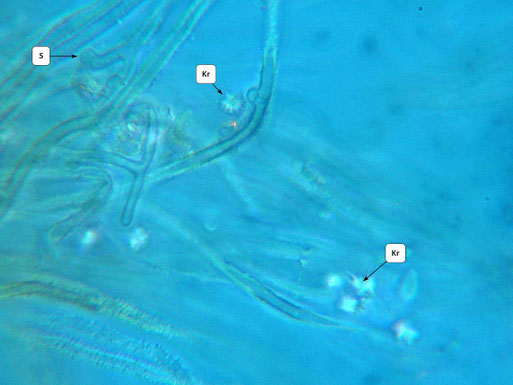 B. Miggel