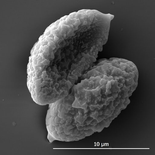 Bild 6 – REM-Aufnahme von Sporen mit ca. 11,5 µm Länge (St. Dillerl)