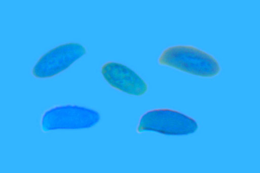 Bild 2 – Sporen der Gelblichen Koralle mit wulstig-Warzigem Ornament, präpariert in Baumwollblau (B. Miggel)
