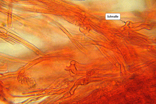 Bild 3 – Generative Hyphen mit Schnallen. Präpariert in Kongorot (B. Miggel)