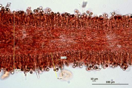 B. Miggel