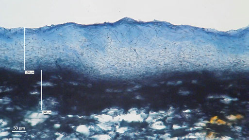  Bild 5 – Querschnitt durch die Huthaut. Präparat mit Tannin-Eisen- Toluidinblau-Färbung. (B. Miggel)