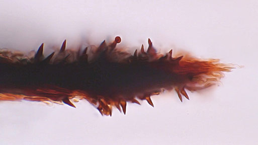 B. Miggel