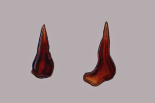 B. Miggel
