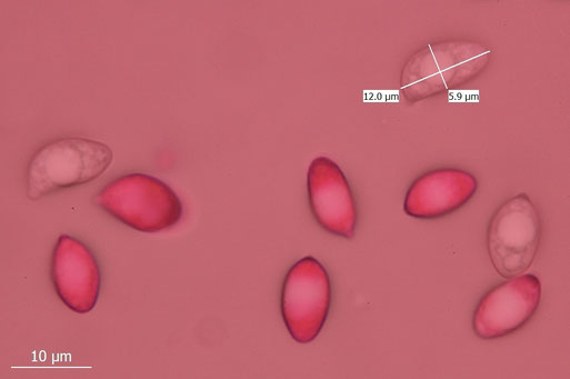 Bild 4 - Sporen, präpariert im Wasser mit etwas Phloxin. (B. Miggel)