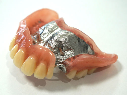チタン金属床義歯