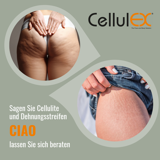 Cellulex Behandlungen Basel buchen