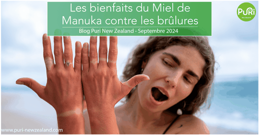 Une femme sur une plage montre ses mains avec un coup de soleil dessus