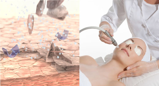 Copyright: Ionto Health & Beauty GmbH