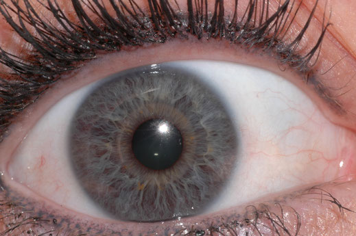 Iridology can help assess the state of the internal organs and the overall constitution of the body.