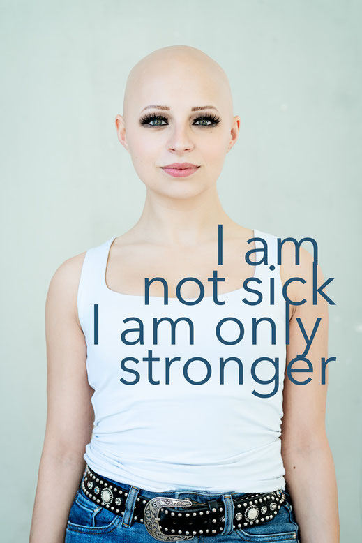 alopecia beauty