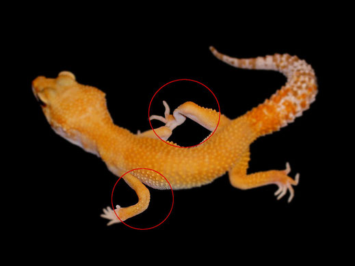 Rachitis - Deformation der Knochen