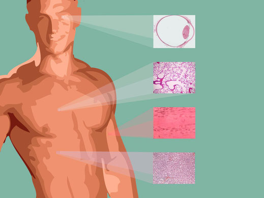 AAV tissue selection diagram.