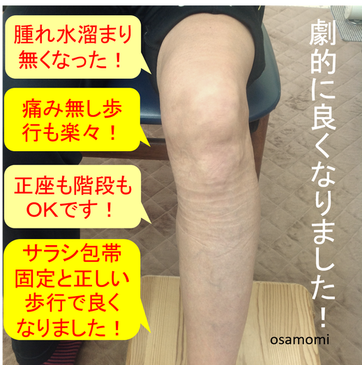 昭島市のオサモミ整体院。変形性膝関節症 膝痛 サラシ包帯固定 拝島駅から無料送迎サービス。