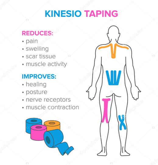 Kinesiotaping=Funktionsunterstützung