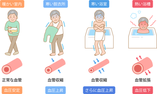 ヒートショック,原因,部屋間温度差,血管収縮,血圧上昇,住宅性能