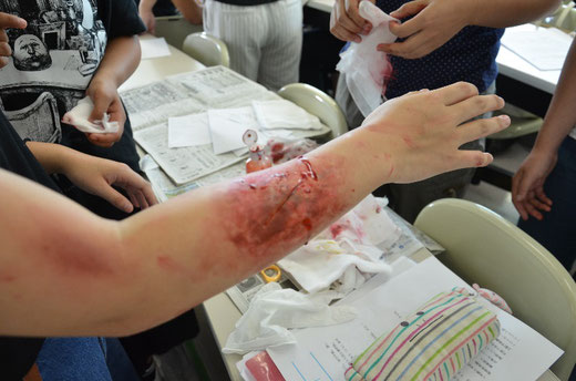 ▲ 学生同士、リアルな傷メイクをして傷病者役で参加しました。