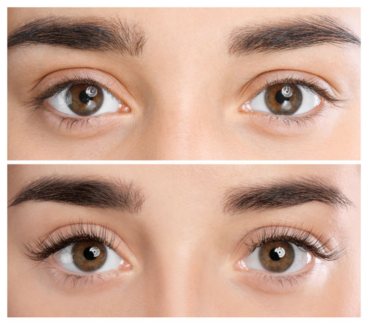 Wimpernlifting kosmetikbedarf PermanentMakeUP GreenPeel Microneedling Microdermabrasion Haarentfernung Gesichtsbehandlung Endermologie Aknebehandlung Farblichttherapie sofri kosmetik sofrischweiz gesichtsbehandlung kosmetik gesichtspflege fusspflege lpg