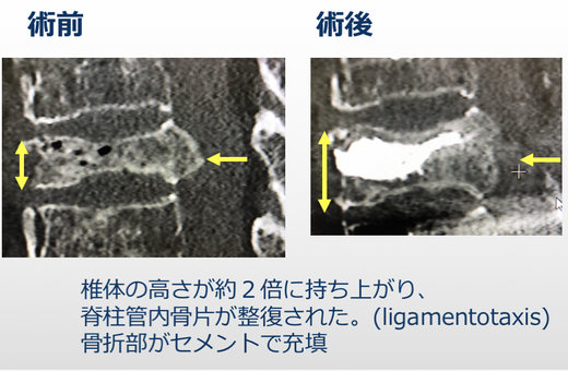 自験例です。