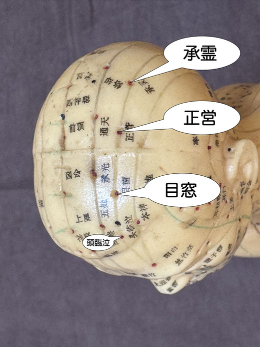 目窓