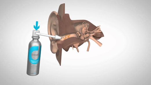 Spray de nettoyage de l'oreille pour enlever le cérumen