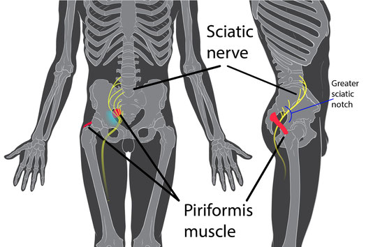 *Piriformis=梨状筋、Sciatice nerve=坐骨神経