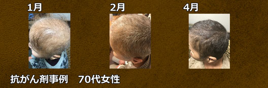 辻式脱毛症研究所 - カラダの内側から髪を元気にするラボ 辻式脱毛症研究所 - カラダの内側から髪を元気にするラボ