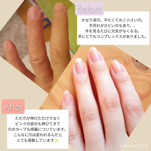 爪は変わる 自爪ケアとマニキュア Hands Up 爪は変わる 自爪ケアとマニキュア Hands Up