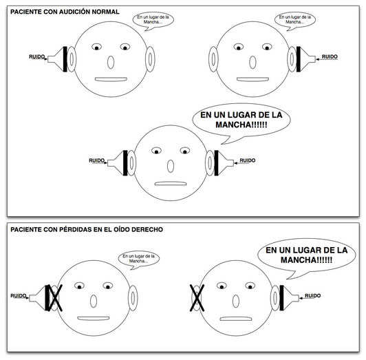 El test de Lombard, útil para detectar simuladores Centro Auditivo