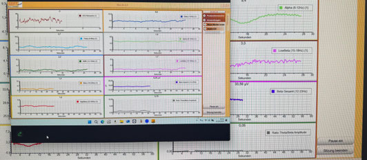 EEG - Messungen mit Rohwerten, Theta, SMR, Beta, High Beta, Low- Beta, Delta, Alpha, Beta Gesamt und Ratio Theta/Beta- Amplitude