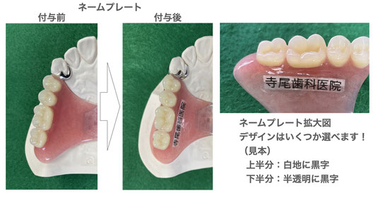 被せ物・入れ歯について。 - てらお総合歯科クリニック