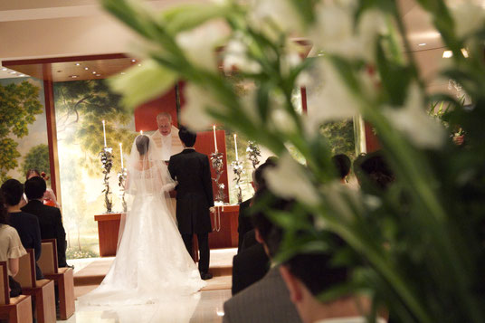 結婚式に向けたブライダルホワイトニングの施術前後比較；ホワイティデンタルクリニック