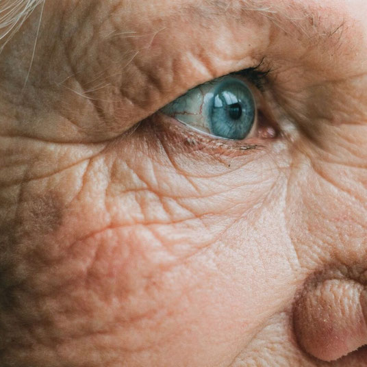 Falten Pigmentflecken anti aging