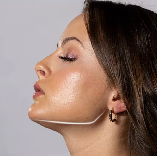Jawline Botox München