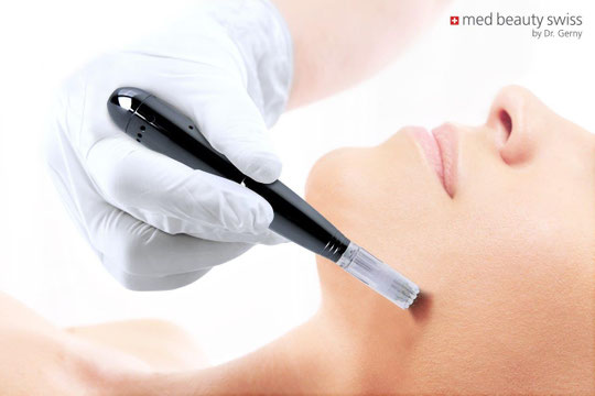 Needling im Kosmetikstudio Carol's Beauty Bar Binningen/Basel