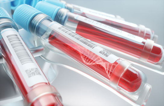 Eigenblut-Gel zur Wundbehandlung?