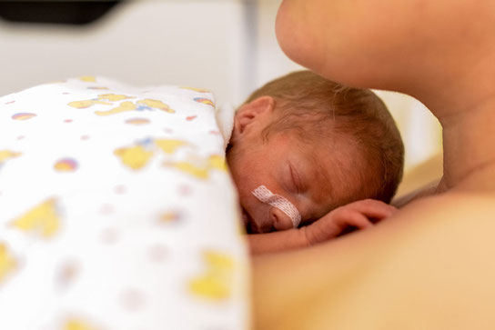 Frühgeborene profitieren von Hautkontakt
