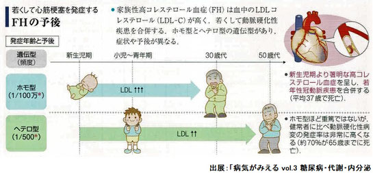 FHの予後