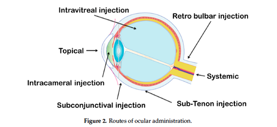 Graphic of an eye which shows the different routes of ocular drug administration