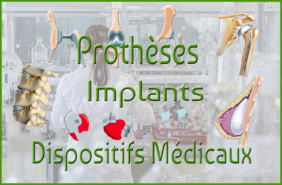 Implants, prothèses et dispositifs médicaux défectueux par l'UPGCS