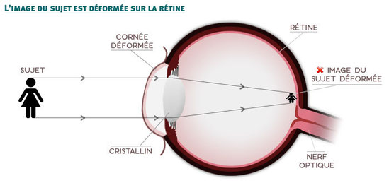 Partie I : de l'oeil au cerveau : quelques aspects de la vision - Site